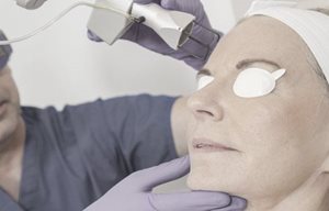 Žena při laserovém ošetření obličeje.