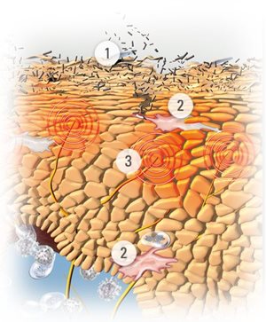 Zobrazení pokožky se symptomy atopické dermatitidy.